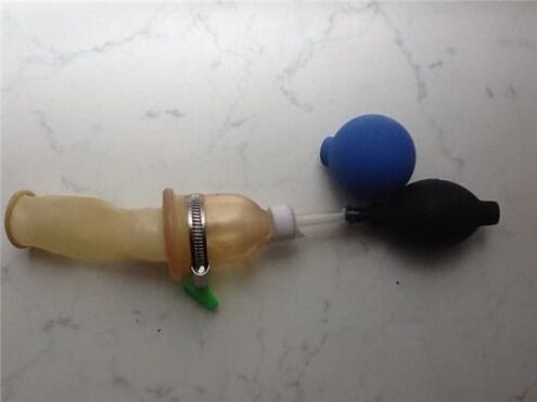 naminis varpos padidinimui