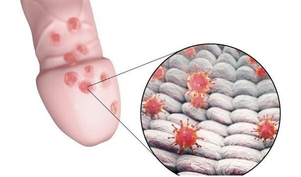 alergija varpos didinimo geliui