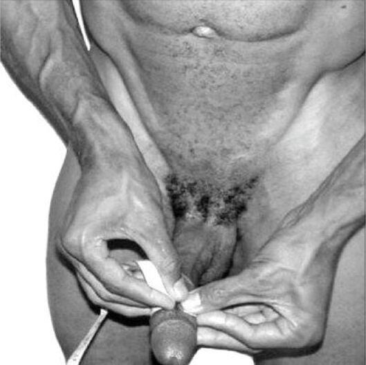 varpos matavimas prieš padidinimą